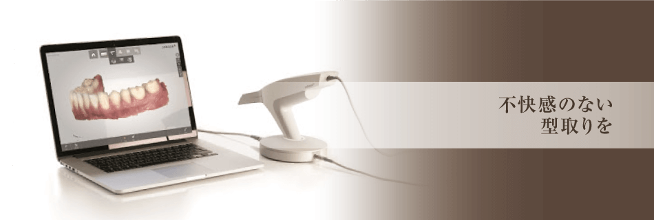 不快感のない型取りを